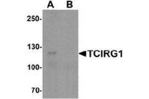 Western Blotting (WB) image for anti-T-Cell, Immune Regulator 1, ATPase, H+ Transporting, Lysosomal V0 Subunit A3 (TCIRG1) (N-Term) antibody (ABIN1450004)