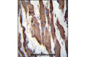 TGFBR Antibody (C-term) 3395b immunohistochemistry analysis in formalin fixed and paraffin embedded human skeletal muscle followed by peroxidase conjugation of the secondary antibody and DAB staining.
