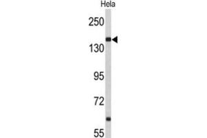 Western Blotting (WB) image for anti-Nucleoporin 153kDa (NUP153) antibody (ABIN3004036) (NUP153 Antikörper)