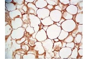 Rat visceral fat tissue was stained by Rabbit Anti-Cathepsin S (298-331) (Human) Serum (Cathepsin S Antikörper  (AA 298-331))