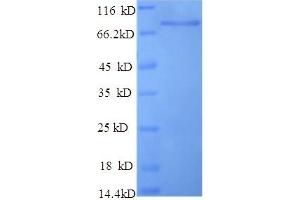 SDS-PAGE (SDS) image for Keratin 10 (KRT10) (AA 1-584), (full length) protein (His tag) (ABIN5709823) (Keratin 10 Protein (KRT10) (AA 1-584, full length) (His tag))