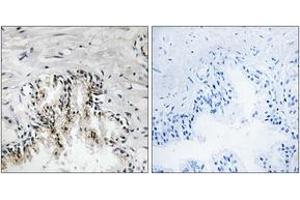 Immunohistochemistry analysis of paraffin-embedded human prostate carcinoma tissue, using RPL31 Antibody.