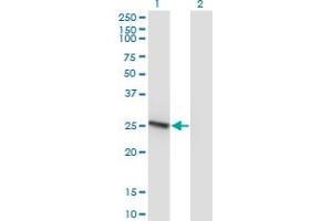 Western Blot analysis of RAB32 expression in transfected 293T cell line by RAB32 monoclonal antibody (M01), clone 1C7. (RAB32 Antikörper  (AA 136-225))