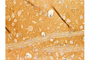 ABIN6265408 and ABIN6268871 at 1/100 staining Rat lung tissue by IHC-P.