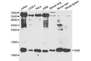 Western blot analysis of extracts of various cell lines, using B2M antibody. (beta-2 Microglobulin Antikörper  (AA 21-119))