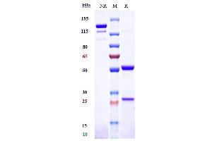 Anti-TNFRSF10B / TRAILR2 / CD262 Reference Antibody (drozitumab) on SDS-PAGE under reducing (R) condition.