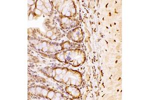 Immunohistochemistry of paraffin embedded rat colon using NAIF1 (ABIN7074867) at dilution of 1:2500 (400x lens) (NAIF1 Antikörper)