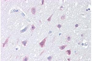 Anti-NPC1 antibody IHC staining of human brain, cortex.