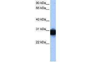 WB Suggested Anti-TPI1 Antibody Titration:  0.