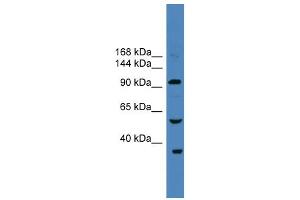 WB Suggested Anti-USP29 Antibody Titration: 0. (USP29 Antikörper  (N-Term))