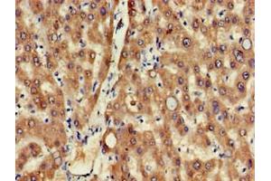 Immunohistochemistry of paraffin-embedded human liver tissue using ABIN7159597 at dilution of 1:100 (MSRB1 Antikörper  (AA 1-116))