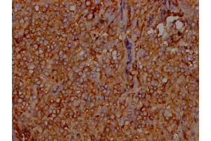 IHC image of ABIN7127599 diluted at 1:100 and staining in paraffin-embedded human adrenal gland tissue performed on a Leica BondTM system. (Rekombinanter LDLR Antikörper)