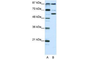 WB Suggested Anti-PCAF Antibody Titration:  2. (KAT2B Antikörper  (N-Term))