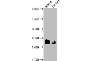 Western Blot Positive WB detected in: MCF-7 whole cell lysate, Jurkat whole cell lysate All lanes: MGMT antibody at 1:1500 Secondary Goat polyclonal to rabbit IgG at 1/50000 dilution Predicted band size: 22 kDa Observed band size: 22 kDa (Rekombinanter MGMT Antikörper)