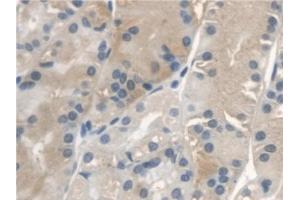 Immunohistochemistry (IHC) image for anti-Insulin-Like Growth Factor Binding Protein 2, 36kDa (IGFBP2) (AA 148-325) antibody (ABIN7430594)