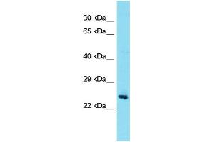 Host: Rabbit Target Name: TEX36 Sample Type: Fetal Brain lysates Antibody Dilution: 1. (TEX36 Antikörper  (Middle Region))