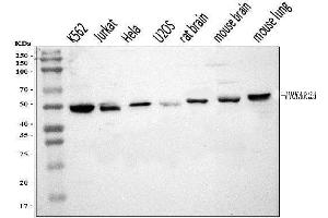 Western blot analysis of PKA R2/PKR2/PRKAR2A using anti-PKA R2/PKR2/PRKAR2A antibody (ABIN7600543).