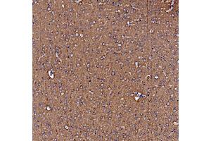 IHC analysis of NSF using anti-NSF antibody (ABIN7601630). (NSF Antikörper  (AA 4-636))