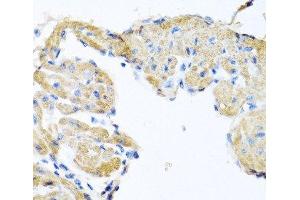 Immunohistochemistry of paraffin-embedded Mouse heart using GPLD1 Polyclonal Antibody at dilution of 1:100 (40x lens).