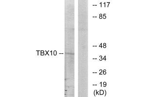 Western Blotting (WB) image for anti-T-Box 10 (TBX10) (Internal Region) antibody (ABIN1849021) (T-Box 10 Antikörper  (Internal Region))