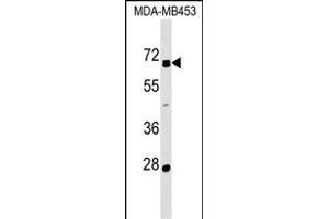 ZN Antibody (N-term) (ABIN1539545 and ABIN2849453) western blot analysis in MDA-M cell line lysates (35 μg/lane). (ZNF565 Antikörper  (N-Term))