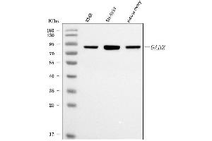Western blot analysis of GAB2 using anti-GAB2 antibody (ABIN7600208).