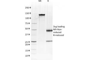 SDS-PAGE Analysis Purified Albumin Mouse Monoclonal Antibody (ALB/2144).