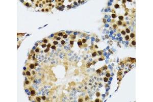 Immunohistochemistry of paraffin-embedded Rat testis using TXNL1 Polyclonal Antibody at dilution of 1:100 (40x lens). (TXNL1 Antikörper)