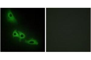 Immunofluorescence analysis of HeLa cells, using GK Antibody. (Glycerol Kinase Antikörper  (AA 461-510))