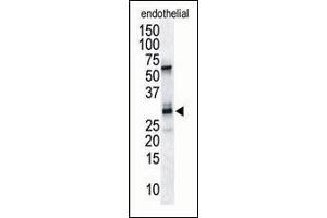 Antibody is used in Western blot to detect RCAN1/DSCR1 in endothelial tissue lysate. (RCAN1 Antikörper  (C-Term))