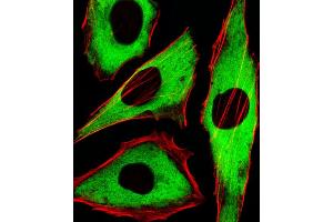 Fluorescent image of Hela cells stained with XAF1 GDH Antibody (ABIN1539789 and ABIN2838005). (GAPDH Antikörper)