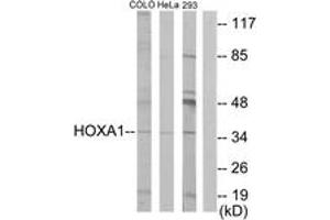 Western blot analysis of extracts from HeLa/COLO/293 cells, using HOXA1 Antibody.