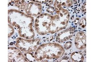 Immunohistochemical staining of paraffin-embedded Kidney tissue using anti-LIPG mouse monoclonal antibody. (LIPG Antikörper)