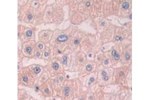 IHC-P analysis of liver tissue, with DAB staining. (APMAP Antikörper  (AA 62-289))