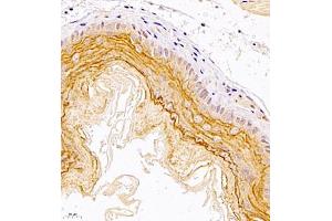 Immunohistochemistry of paraffin embedded mouse esophagus using TR2IT1 (ABIN7075887) at dilution of 1:1500 (400x lens) (TXNRD3NB Antikörper)