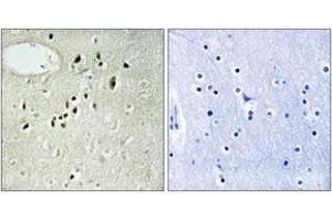 Immunohistochemistry analysis of paraffin-embedded human brain tissue, using EMX2 Antibody. (EMX2 Antikörper  (AA 91-140))