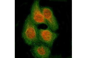 IF analysis of RBM14 using anti-RBM14 antibody (ABIN7599521) and anti-Tubulin Alpha antibody (ABIN7600339).
