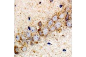 Immunohistochemical analysis of VPS37A staining in rat brain formalin fixed paraffin embedded tissue section. (VPS37A Antikörper)