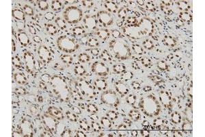 Image no. 5 for anti-Regulation of Nuclear Pre-mRNA Domain Containing 1A (RPRD1A) (AA 76-171) antibody (ABIN466219) (RPRD1A Antikörper  (AA 76-171))