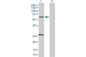 Western Blot analysis of SOCS4 expression in transfected 293T cell line by SOCS4 MaxPab polyclonal antibody. (SOCS4 Antikörper  (AA 1-440))