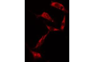 ABIN6274203 staining NIH-3T3 cells by IF/ICC. (RPS6KB1 Antikörper  (C-Term))