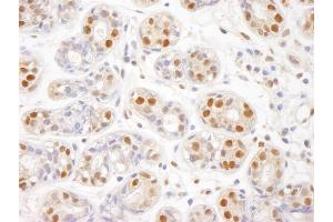 Immunohistochemistry (IHC) image for anti-Structural Maintenance of Chromosomes 1A (SMC1A) (C-Term) antibody (ABIN7448802)