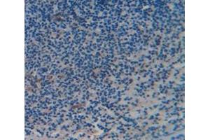 IHC-P analysis of Kidney tissue, with DAB staining. (CD6 Antikörper  (AA 477-644))