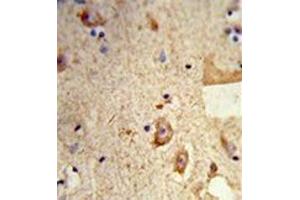 Formalin-fixed and paraffin-embedded human brain tissue reacted with Destrin Antibody , which was peroxidase-conjugated to the secondary antibody, followed by DAB staining. (Destrin Antikörper  (Middle Region))