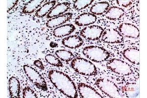Immunohistochemistry (IHC) image for anti-Tumor Protein P73 (TP73) (Tyr221) antibody (ABIN3187855)