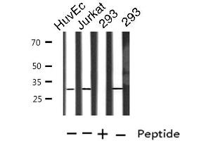 Western blot analysis of extracts from HuvEc/Jurkat/293 cells, using TOLLIP antibody. (TOLLIP Antikörper  (Internal Region))