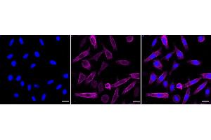 Immunocytochemical staining of Hela cells with Moesin antibody (ABIN7799482), 1:1,000).