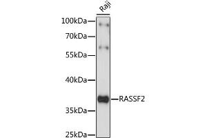 Western blot analysis of extracts of Raji cells, using R antibody (ABIN7269859) at 1:1000 dilution. (RASSF2 Antikörper  (AA 70-160))