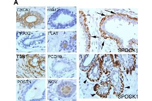 Western Blotting (WB) image for anti-Periostin (POSTN) (C-Term) antibody (ABIN2854805)