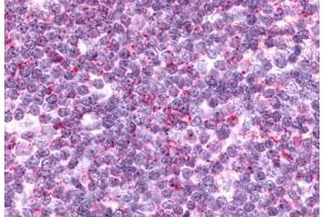 Anti-CCR9 antibody  ABIN1048405 IHC staining of human thymus, lymphocytes. (CCR9 Antikörper  (Cytoplasmic Domain))